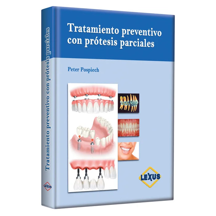 Tratamiento Preventivo con Prótesis Parciales