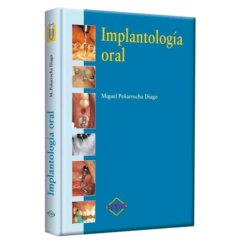 Implantología Oral