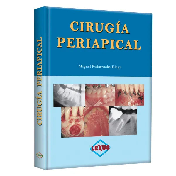 Cirugía Periapical