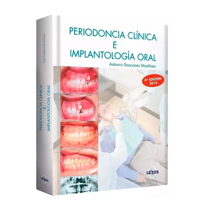 Periodoncia Clínica e Implantología Oral