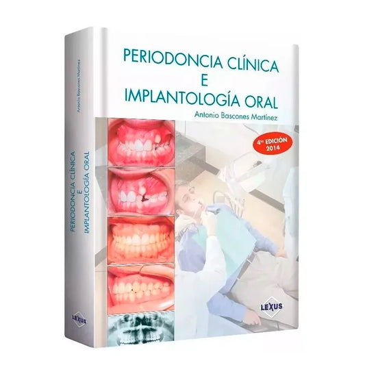 Periodoncia Clínica e Implantología Oral